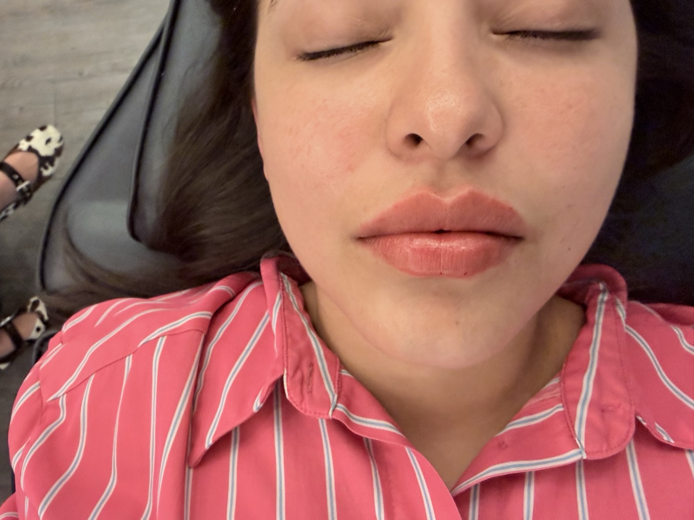 Aumento de labios natural — Seleah Zona Esmeralda